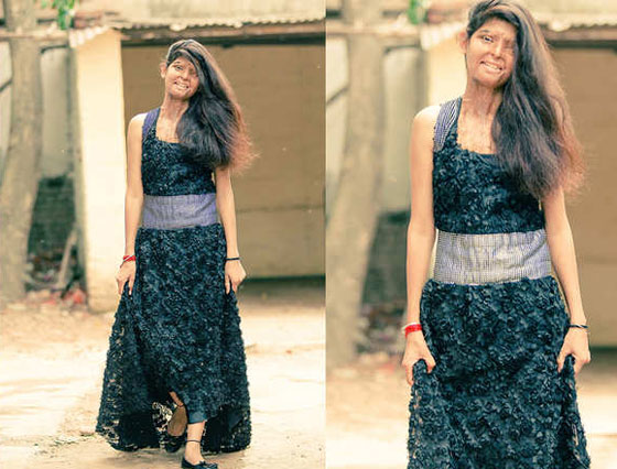 بالصور: جلسة تصوير لمشوهات بماء النار في الهند! صورة رقم 1