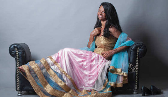 بالصور: جلسة تصوير لمشوهات بماء النار في الهند! صورة رقم 5