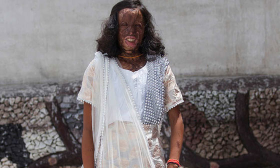 بالصور: جلسة تصوير لمشوهات بماء النار في الهند! صورة رقم 6