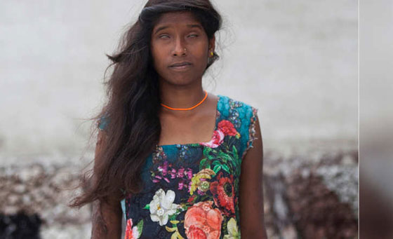 بالصور: جلسة تصوير لمشوهات بماء النار في الهند! صورة رقم 7