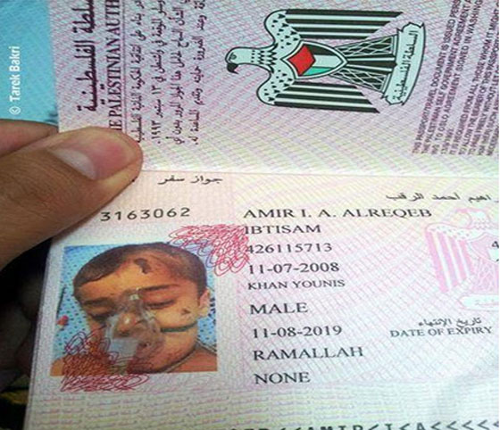 صورة على جواز السفر لطفل فلسطيني مصاب ومتصل بجهاز تنفس صورة رقم 1
