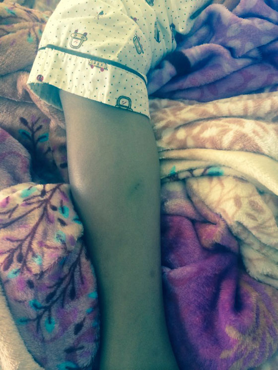  مقتل طفلة سعودية على يد زوجة ابيها لأنها أكلت قطعة بسكوت صورة رقم 4