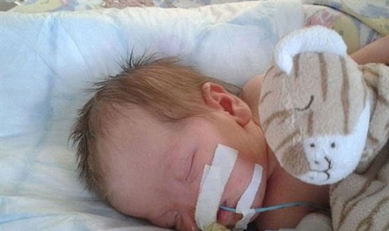 حالة نادرة.. طفلة ايرلندية بدون انف!! صورة رقم 5