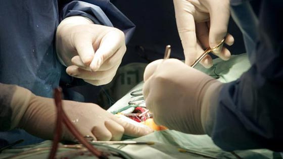 الإله شيفا يسكن هندوسيا ويدفعه للمخاطرة بابتلاع اربعة قضبان معدنية صورة رقم 1