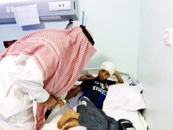 الطفل المسلوخ: والدي سكب عليّ مادة حارقة لانني رفضت السرقة! صورة رقم 3