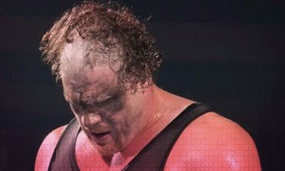 قصات شعر غريبة تدفع باصحابها المصارعين للمقدمة.. شاهد صورهم صورة رقم 3