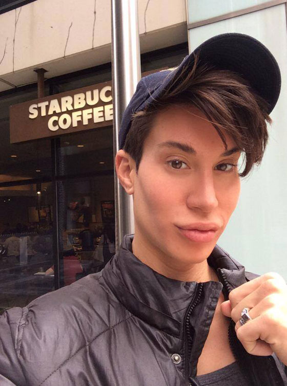 بالصور.. 100 عملية جراحية تجعل شابا شبيه الدمية (كين) صورة رقم 13