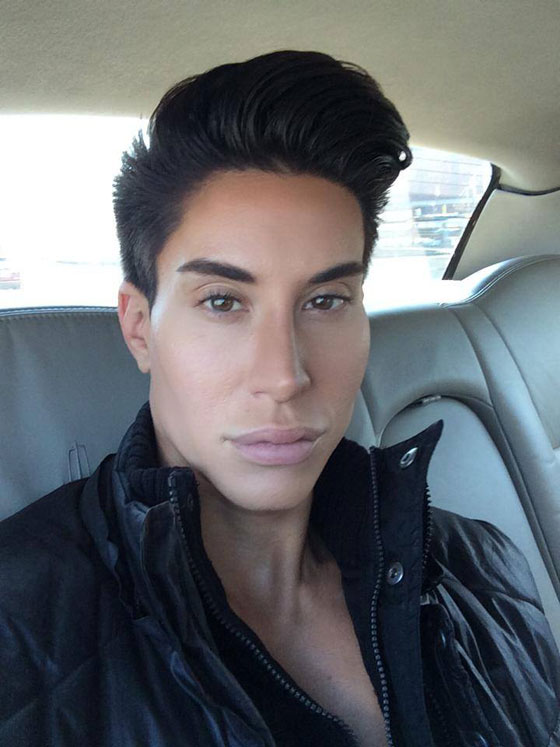 بالصور.. 100 عملية جراحية تجعل شابا شبيه الدمية (كين) صورة رقم 7