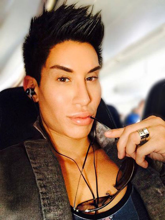 بالصور.. 100 عملية جراحية تجعل شابا شبيه الدمية (كين) صورة رقم 8