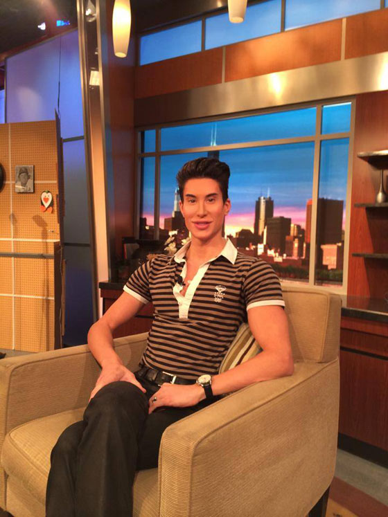 بالصور.. 100 عملية جراحية تجعل شابا شبيه الدمية (كين) صورة رقم 11