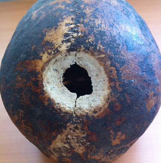 بالصور.. جمجمة بشرية تثبت ان القدماء برعوا في جراحة المخ صورة رقم 2