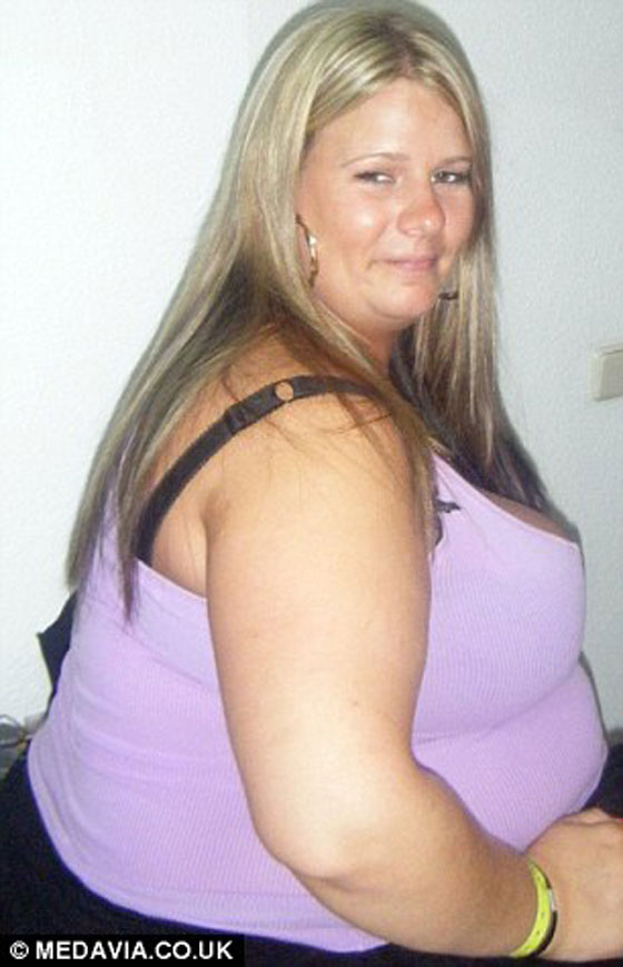 السمنة الزائدة تتسبب بتأجيل عروس لزفافها مدة 17 عاما!! صورة رقم 5