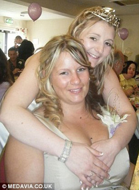 السمنة الزائدة تتسبب بتأجيل عروس لزفافها مدة 17 عاما!! صورة رقم 8