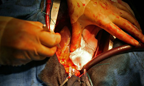 بالصور.. عاش لمدة شهرين مع رصاصة في القلب صورة رقم 4