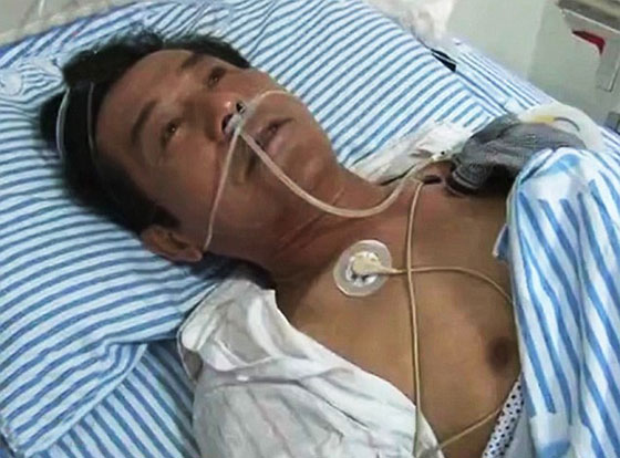 معاناة اربعين عاما تنتهي باكتشاف ابرة منغرسة في الاحشاء!! صورة رقم 1