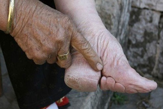 اليابانيون يحبون المرأة قصيرة نحيلة، العرب يريدونها بدينة طويلة الشعر، والافارقة يعشقونها صلعاء صورة رقم 2