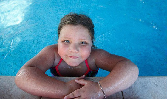 خطأ طبي جعل طفلة يزيد وزنها بكيلوغرام واحد كل اسبوع صورة رقم 1