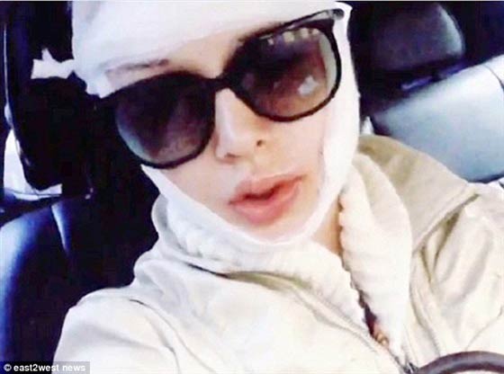 بالصور.. مجهولان يهاجمان 