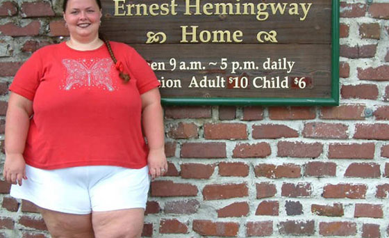 بالصور.. شابة تتحول من الاكل السريع الى الفواكه وتخسر 68 كغم صورة رقم 3