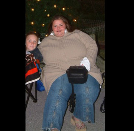 بالصور.. شابة تتحول من الاكل السريع الى الفواكه وتخسر 68 كغم صورة رقم 2