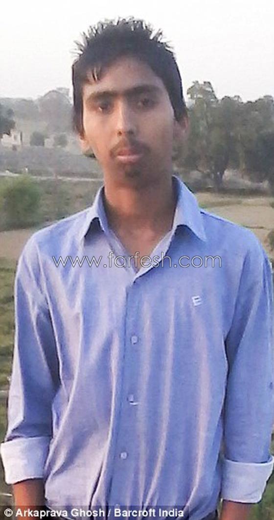 هندي يفتح فمه لاول منذ 8 سنوات بعد حالة تشنج بسبب صدمة صورة رقم 2