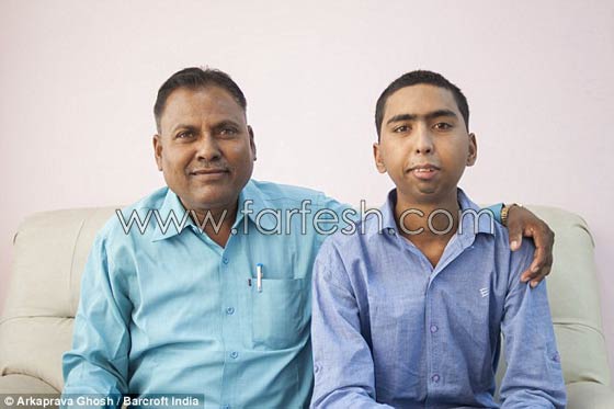 هندي يفتح فمه لاول منذ 8 سنوات بعد حالة تشنج بسبب صدمة صورة رقم 5