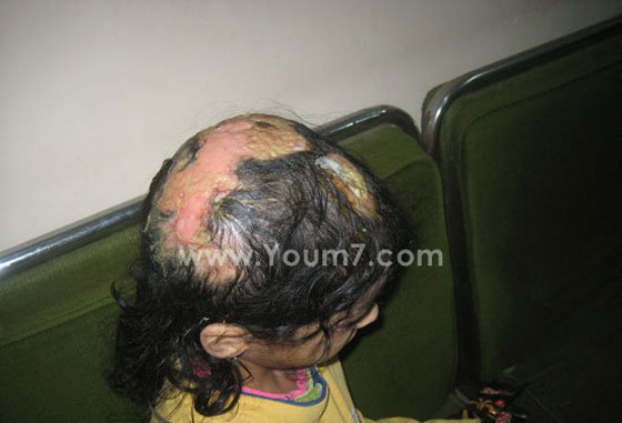  مصر: عضو حزب سياسي ديني يعذب ابنته ويسجنها لانها أكلت كفتة صورة رقم 1