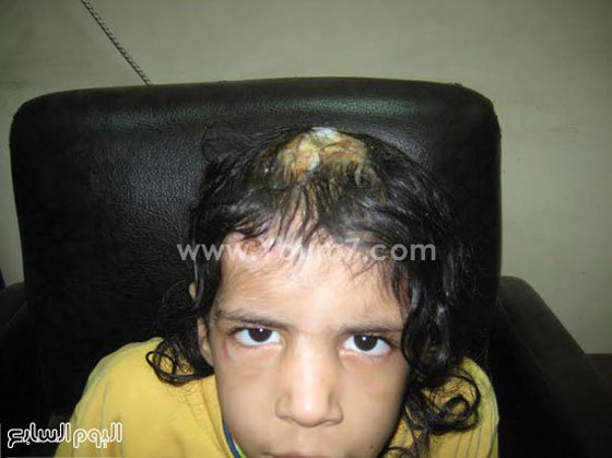  مصر: عضو حزب سياسي ديني يعذب ابنته ويسجنها لانها أكلت كفتة صورة رقم 4