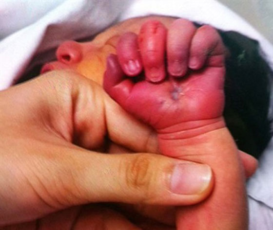 بالصور.. أم تنهش يد مولودها البالغ 3 ايام وتشوهها صورة رقم 4