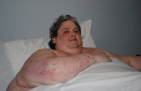  وفاة البريطاني كيث مارتن اسمن رجل في العالم ويزن 490 كغم صورة رقم 1