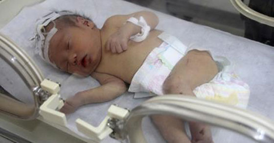 بالصور.. رضيعة وجدت على قيد الحياة بعد ساعتين من دفنها صورة رقم 2