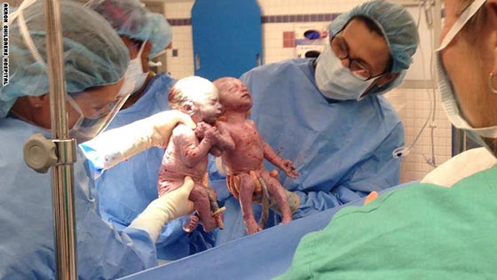 شاهد بالصور.. الجزء الثاني من أبرز صور واحداث عام 2014 صورة رقم 14