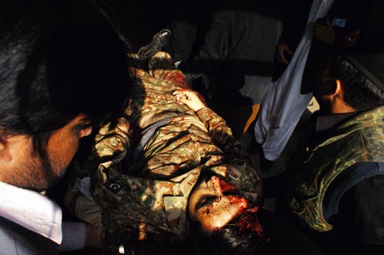 بالصور.. شاهد بشاعة ما احدثه هجوم طالبان على المدرسة الباكستانية صورة رقم 16