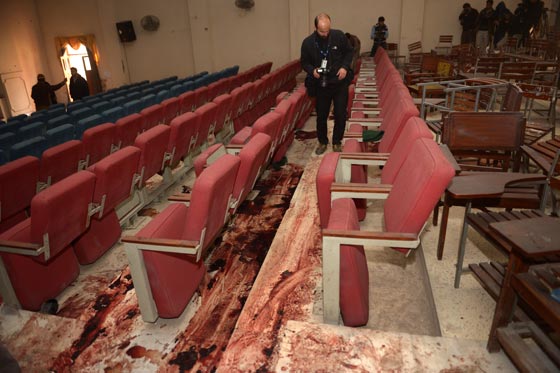 بالصور.. شاهد بشاعة ما احدثه هجوم طالبان على المدرسة الباكستانية صورة رقم 34