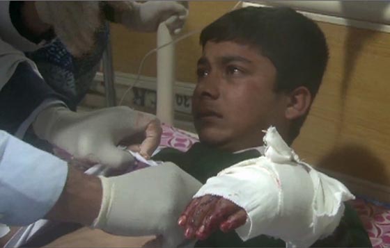 بالصور.. شاهد بشاعة ما احدثه هجوم طالبان على المدرسة الباكستانية صورة رقم 43