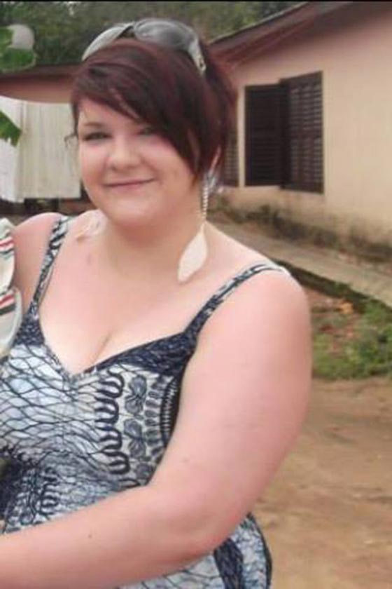 صور فتاة تنزل وزنها 38 كغم خلال اشهر بسبب سخرية أصدقائها صورة رقم 1