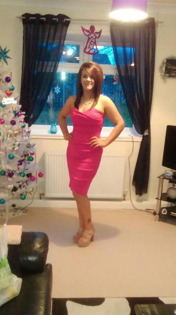 صور فتاة تنزل وزنها 38 كغم خلال اشهر بسبب سخرية أصدقائها صورة رقم 5