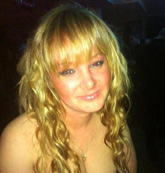 بالصور.. سرطان اللسان يقتل شابة بريطانية بعد 12 ساعة من زواجها صورة رقم 5