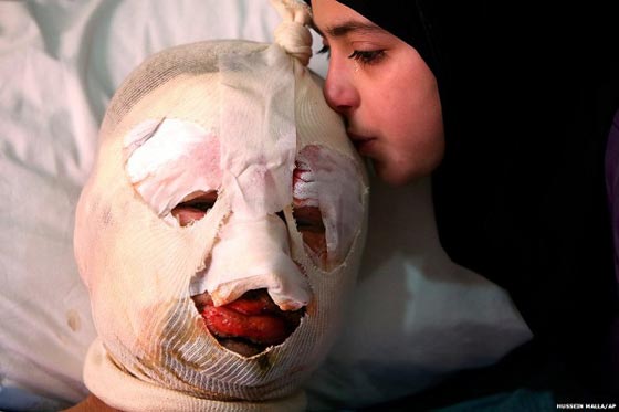 سجل مصور لعام 2014.. صور تعبر عن ملايين الكلمات صورة رقم 16