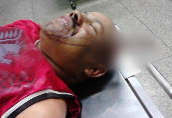 بقي السكين في رأسه مدة ساعتين بعد طعنه.. وكتبت له الحياة باعجوبة صورة رقم 3