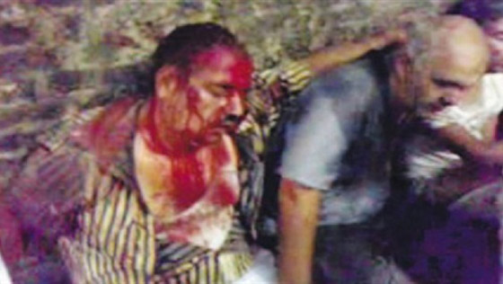 زوجة أحد الشهداء: جميع سكان كرداسة شاركوا بالمذبحة ومثلوا بالجثث صورة رقم 1