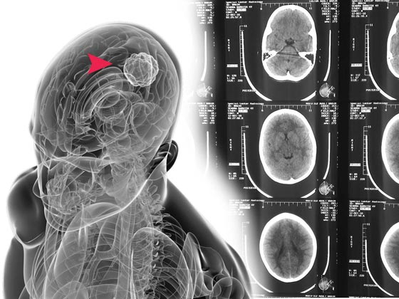 اذا كنت مصابا باحد هذه الامراض.. لا مكان لك في مجلس الشعب صورة رقم 2