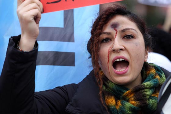 مطالبة باقالة وزير تركي بعد اغتصاب شابة وحرقها حية صورة رقم 6 مطالبة باقالة وزير تركي بعد اغتصاب شابة وحرقها حية صورة رقم 6