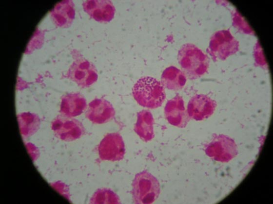  ظهور نوع جديد من الايدز في كوبا اشد فتكا بالبشرية صورة رقم 3