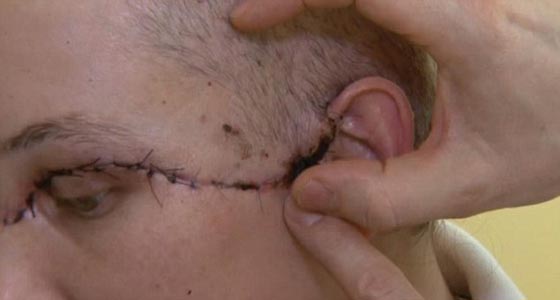 بالصور.. امرأة تفقد شعرها، حاجبيها ورموشها بصعقة كهربائية مدمرة صورة رقم 1