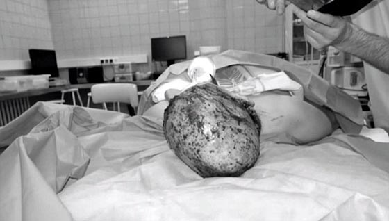 بالصور.. امرأة تفقد شعرها، حاجبيها ورموشها بصعقة كهربائية مدمرة صورة رقم 5