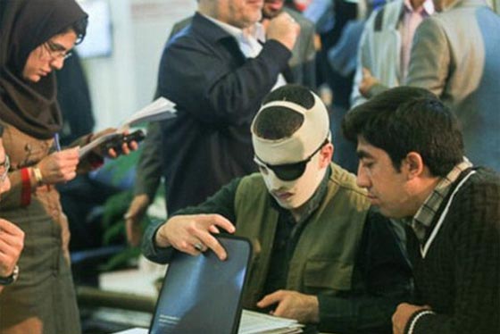 العين بالعين.. محكمة ايران تفقأ عين متهم بافقاد رجل بصره صورة رقم 3 العين بالعين.. محكمة ايران تفقأ عين متهم بافقاد رجل بصره صورة رقم 3