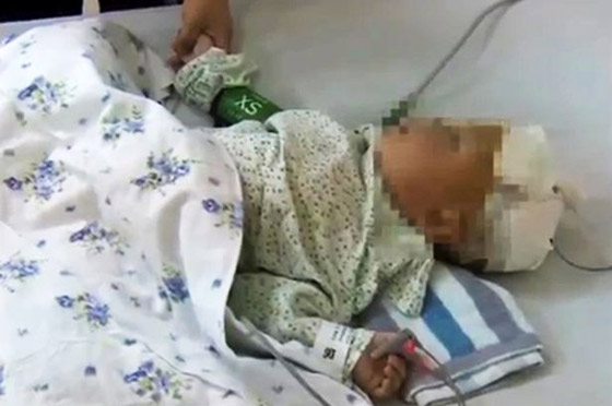 فيديو وصور.. عود الطعام يخترق راس رضيع صيني صورة رقم 1 فيديو وصور.. عود الطعام يخترق راس رضيع صيني صورة رقم 1