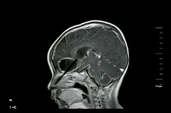 فيديو وصور.. عود الطعام يخترق راس رضيع صيني صورة رقم 2 فيديو وصور.. عود الطعام يخترق راس رضيع صيني صورة رقم 2