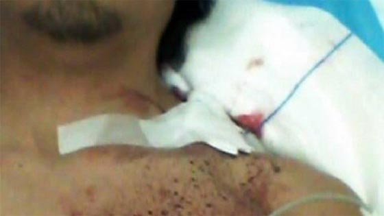  أصيب بعيار ناري وطمأن اصدقاءه بصورة سيلفي لمكان الاصابة صورة رقم 2